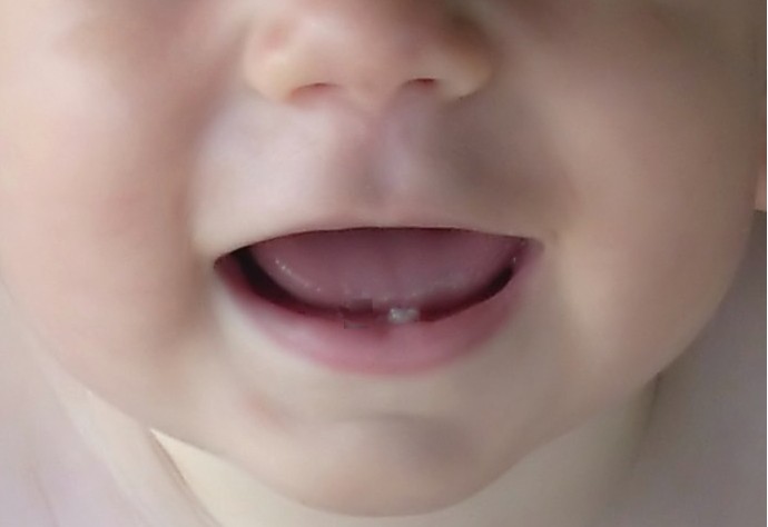 http://babytoddleretc.files.wordpress.com/2008/06/baby-teeth2.jpg